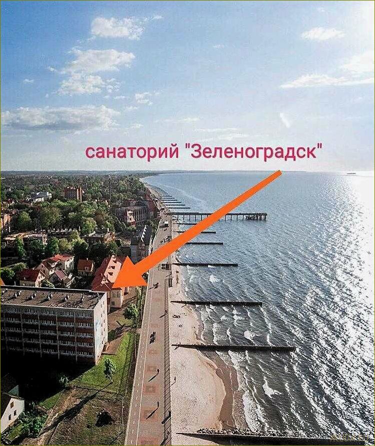 Зеленоград Калининградская область — идеальное место для отдыха на море в санаториях